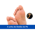 A unha do dedão do pé